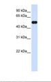 MNDA Antibody - Transfected 293T cell lysate. Antibody concentration: 1.0 ug/ml. Gel concentration: 12%.  This image was taken for the unconjugated form of this product. Other forms have not been tested.