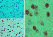 MNX1 / HB9 Antibody - IHC of HB9 in formalin-fixed, paraffin-embedded mouse pancreas tissue using an isotype control (top left) and Polyclonal Antibody to HB9 (bottom left, right) at 5 ug/ml.