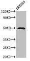 MNX1 / HB9 Antibody - Positive Western Blot detected in HEK293 whole cell lysate. All lanes: MNX1 antibody at 2 µg/ml Secondary Goat polyclonal to rabbit IgG at 1/50000 dilution. Predicted band size: 41, 21 KDa. Observed band size: 41 KDa