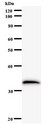 MOB2 Antibody - Western blot of immunized recombinant protein using HCCA2 antibody.