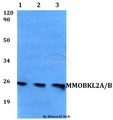 MOB3A / MOBKL2A Antibody - Western blot of MMOBKL2A/B antibody at 1:500 dilution. Lane 1: HEK293T whole cell lysate. Lane 2: sp2/0 whole cell lysate. Lane 3: PC12 whole cell lysate.