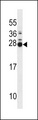 MOBKL2B / MOB3B Antibody - MOL2B Antibody western blot of mouse spleen tissue lysates (35 ug/lane). The MOL2B antibody detected the MOL2B protein (arrow).