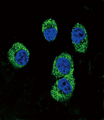 MOK / RAGE Antibody - Confocal immunofluorescence of RAGE Antibody with MDA-MB231 cell followed by Alexa Fluor 488-conjugated goat anti-rabbit lgG (green). DAPI was used to stain the cell nuclear (blue).