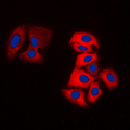 MOK / RAGE Antibody - Immunofluorescent analysis of MOK staining in MDAMB231 cells. Formalin-fixed cells were permeabilized with 0.1% Triton X-100 in TBS for 5-10 minutes and blocked with 3% BSA-PBS for 30 minutes at room temperature. Cells were probed with the primary antibody in 3% BSA-PBS and incubated overnight at 4 C in a humidified chamber. Cells were washed with PBST and incubated with a DyLight 594-conjugated secondary antibody (red) in PBS at room temperature in the dark. DAPI was used to stain the cell nuclei (blue).