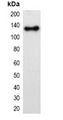 mOrange Tag Antibody - Western blot analysis of over-expressed mOrange-tagged protein in 293T cell lysate.