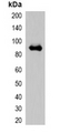mOrange Tag Antibody - Western blot analysis of over-expressed mOrange-tagged protein in 293T cell lysate.