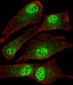 MORC2 Antibody - Fluorescent image of U-87 MG cells stained with MORC2 Antibody. Antibody was diluted at 1:25 dilution. An Alexa Fluor 488-conjugated goat anti-rabbit lgG at 1:400 dilution was used as the secondary antibody (green). Cytoplasmic actin was counterstained with Alexa Fluor 555 conjugated with Phalloidin (red).