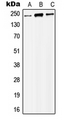 MORF / MYST4 Antibody - Western blot analysis of MYST4 expression in HEK293T (A); Raw264.7 (B); NIH3T3 (C) whole cell lysates.
