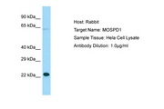 MOSPD1 Antibody -  This image was taken for the unconjugated form of this product. Other forms have not been tested.