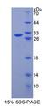 ABCB4 / MDR3 Protein - Recombinant ATP Binding Cassette Transporter B4 (ABCB4) by SDS-PAGE
