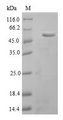 ACLP / AEBP1 Protein - (Tris-Glycine gel) Discontinuous SDS-PAGE (reduced) with 5% enrichment gel and 15% separation gel.