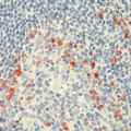 Human Kappa Light Chain Antibody - Formalin-fixed, paraffin-embedded human tonsil stained with peroxidase-conjugate and AEC chromogen. Note cytoplasmic staining of B lymphocytes.  This image was taken for the unmodified form of this product. Other forms have not been tested.