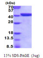 ANXA1 / Annexin A1 Protein