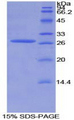 AXIN1 / Axin-1 Protein - Recombinant Axis Inhibition Protein By SDS-PAGE