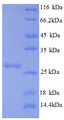 BCL2 / Bcl-2 Protein