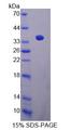 CABIN1 Protein - Recombinant Calcineurin Binding Protein 1 By SDS-PAGE