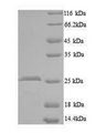 CCN5 Protein - (Tris-Glycine gel) Discontinuous SDS-PAGE (reduced) with 5% enrichment gel and 15% separation gel.