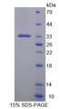 CD19 Protein - Recombinant Cluster Of Differentiation 19 By SDS-PAGE
