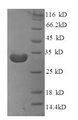 CD20 Protein - (Tris-Glycine gel) Discontinuous SDS-PAGE (reduced) with 5% enrichment gel and 15% separation gel.