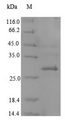 CD207 / Langerin Protein - (Tris-Glycine gel) Discontinuous SDS-PAGE (reduced) with 5% enrichment gel and 15% separation gel.