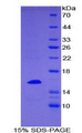 CD27L / CD70 Protein - Recombinant Tumor Necrosis Factor Ligand Superfamily, Member 7 By SDS-PAGE
