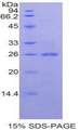 CLCF1 Protein - Recombinant Cardiotrophin Like Cytokine Factor 1 By SDS-PAGE