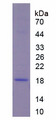COL8A1 / Collagen VIII Alpha 1 Protein - Recombinant Collagen Type VIII Alpha 1 By SDS-PAGE