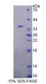 Complement C8A Protein - Recombinant Complement Component 8a (C8a) by SDS-PAGE
