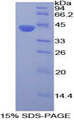 CP / Ceruloplasmin Protein - Recombinant Ceruloplasmin By SDS-PAGE
