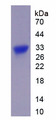 CTNNB1 / Beta Catenin Protein - Recombinant Catenin Beta 1 By SDS-PAGE