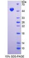 DAG1 / Dystroglycan Protein - Recombinant  Dystrophin Associated Glycoprotein 1 By SDS-PAGE