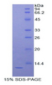 DBI / ACBD1 Protein - Recombinant Diazepam Binding Inhibitor By SDS-PAGE
