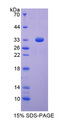 DFFA / ICAD / DFF45 Protein - Recombinant DNA Fragmentation Factor Subunit Alpha By SDS-PAGE