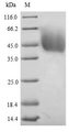 DLAT / PDC-E2 Protein - (Tris-Glycine gel) Discontinuous SDS-PAGE (reduced) with 5% enrichment gel and 15% separation gel.
