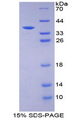 EIF2AK2 / PKR Protein - Recombinant Protein Kinase R By SDS-PAGE