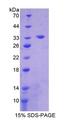 EPHB3 / EPH Receptor B3 Protein - Recombinant  Ephrin Type B Receptor 3 By SDS-PAGE