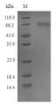 FAM83D Protein - (Tris-Glycine gel) Discontinuous SDS-PAGE (reduced) with 5% enrichment gel and 15% separation gel.