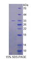 FES Protein - Recombinant  Feline Sarcoma Oncogene By SDS-PAGE