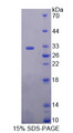 GLDC Protein - Recombinant  Glycine Dehydrogenase By SDS-PAGE