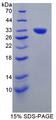 GLMN Protein - Recombinant  Glomulin By SDS-PAGE