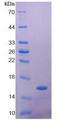 GLP1R / GLP-1 Receptor Protein - Recombinant Glucagon Like Peptide 1 Receptor By SDS-PAGE