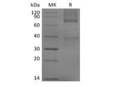 GPC3 / Glypican 3 Protein - Recombinant Mouse Glypican-3/GPC3/OCI5 (C-6His)