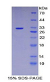 GPV / CD42d Protein - Recombinant Glycoprotein V, Platelet By SDS-PAGE