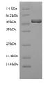 HAS2 Protein - (Tris-Glycine gel) Discontinuous SDS-PAGE (reduced) with 5% enrichment gel and 15% separation gel.