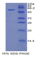 HGFAC / HGFA Protein - Recombinant Hepatocyte Growth Factor Activator By SDS-PAGE