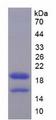 HMGIY / HMGA1 Protein - Recombinant High Mobility Group AT Hook Protein 1 By SDS-PAGE