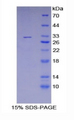 HSP90B1 / GP96 / GRP94 Protein - Recombinant Heat Shock Protein 90kDa Beta 1 (HSP90b1) by SDS-PAGE