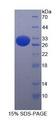 ITGAE / CD103 Protein - Recombinant Integrin Alpha E By SDS-PAGE