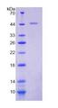 KISS1 / Kisspeptin / Metastin Protein - Recombinant  Kisspeptin 1 By SDS-PAGE