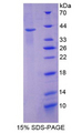 KRT2 / CK2 / Cytokeratin 2 Protein - Recombinant Keratin 2 By SDS-PAGE